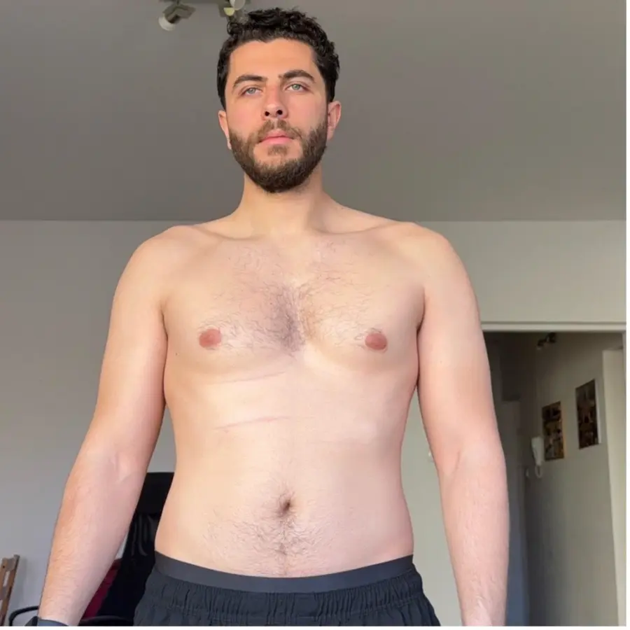 Before — 4 months