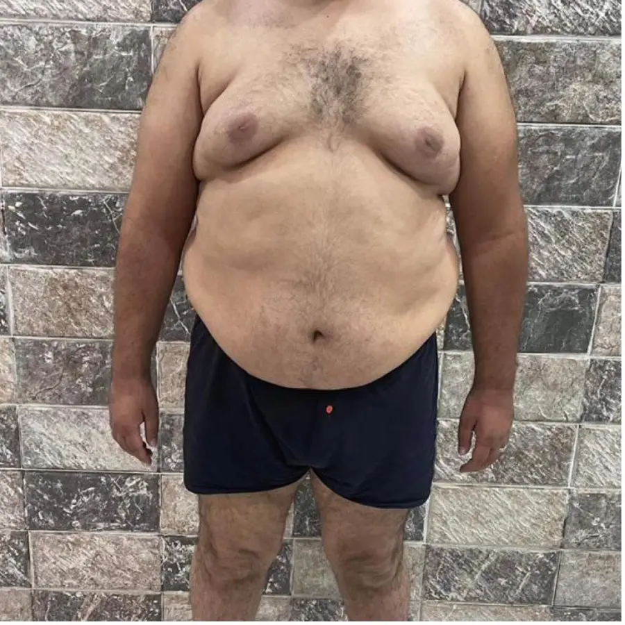 Before — 6 months